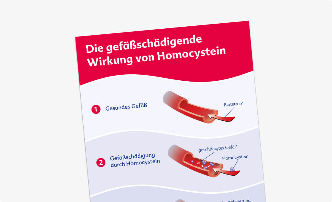 Gefäßschädigende Wirkung von Homocystein