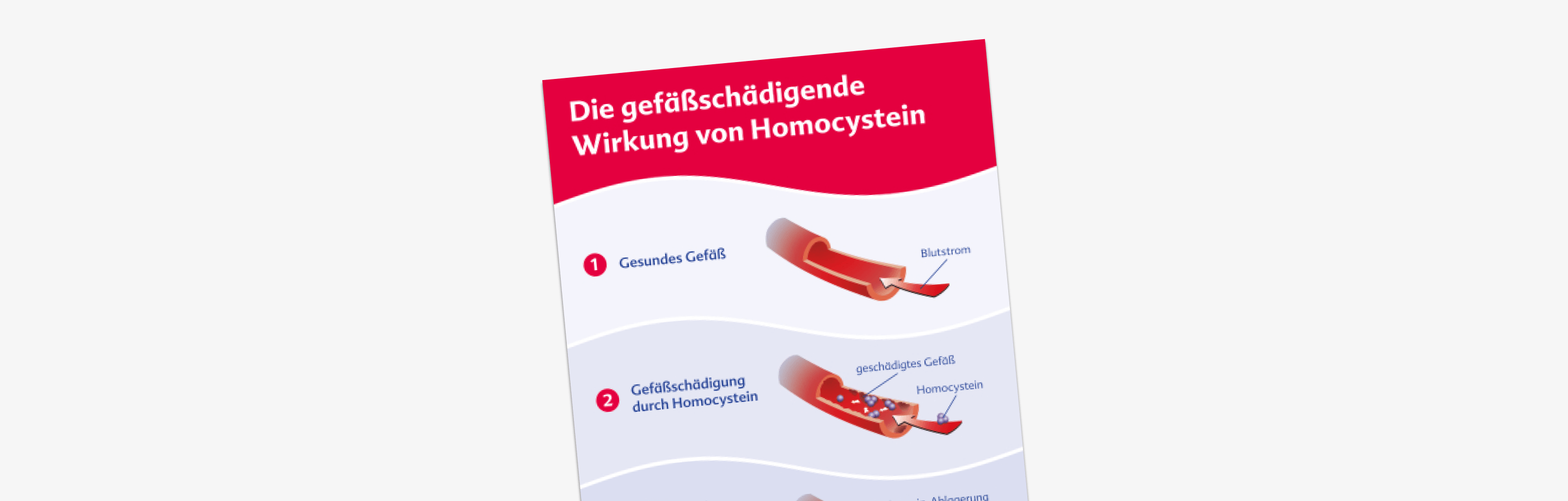 Gefäßschädigende Wirkung von Homocystein