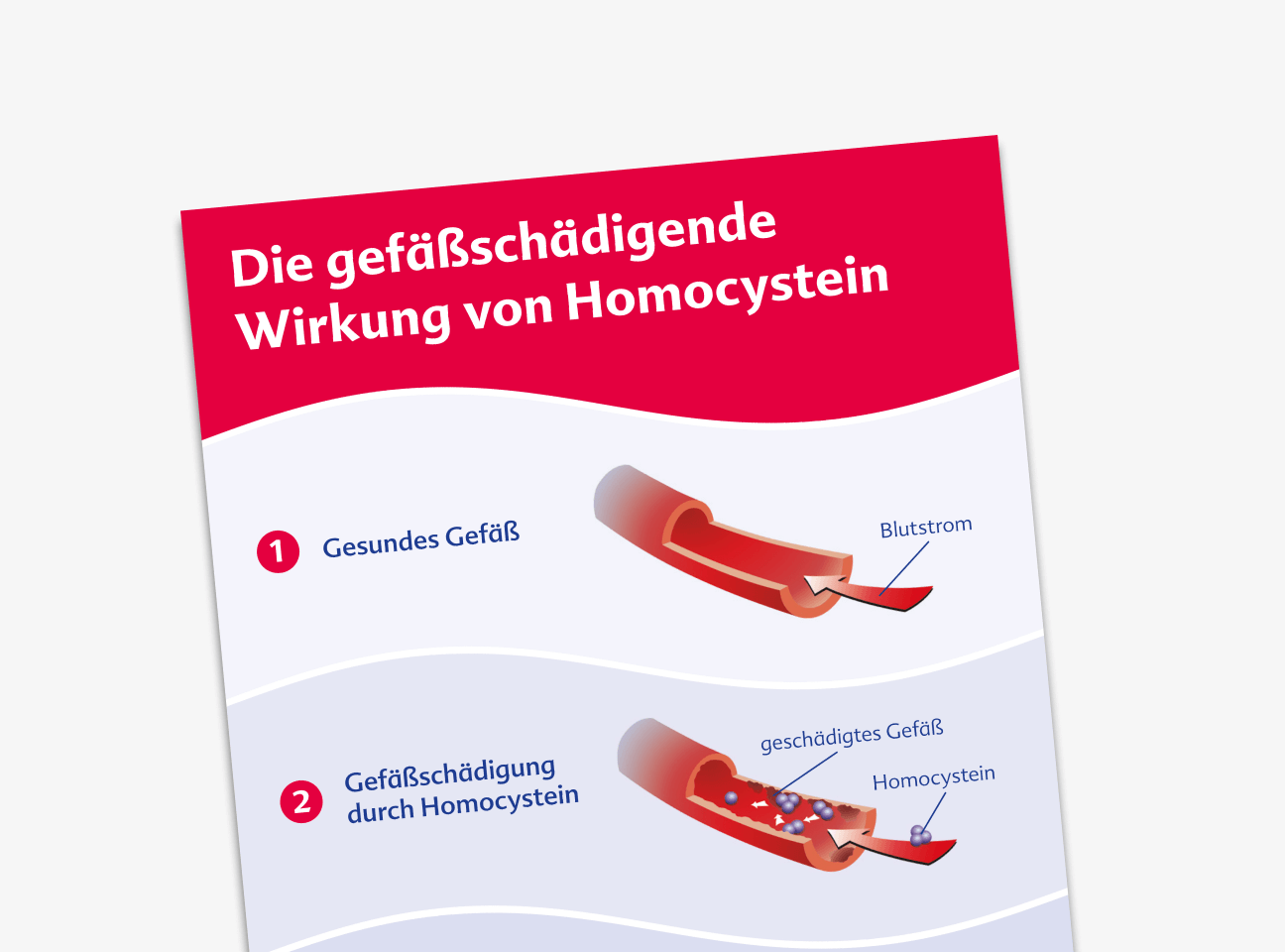 Gefäßschädigende Wirkung von Homocystein