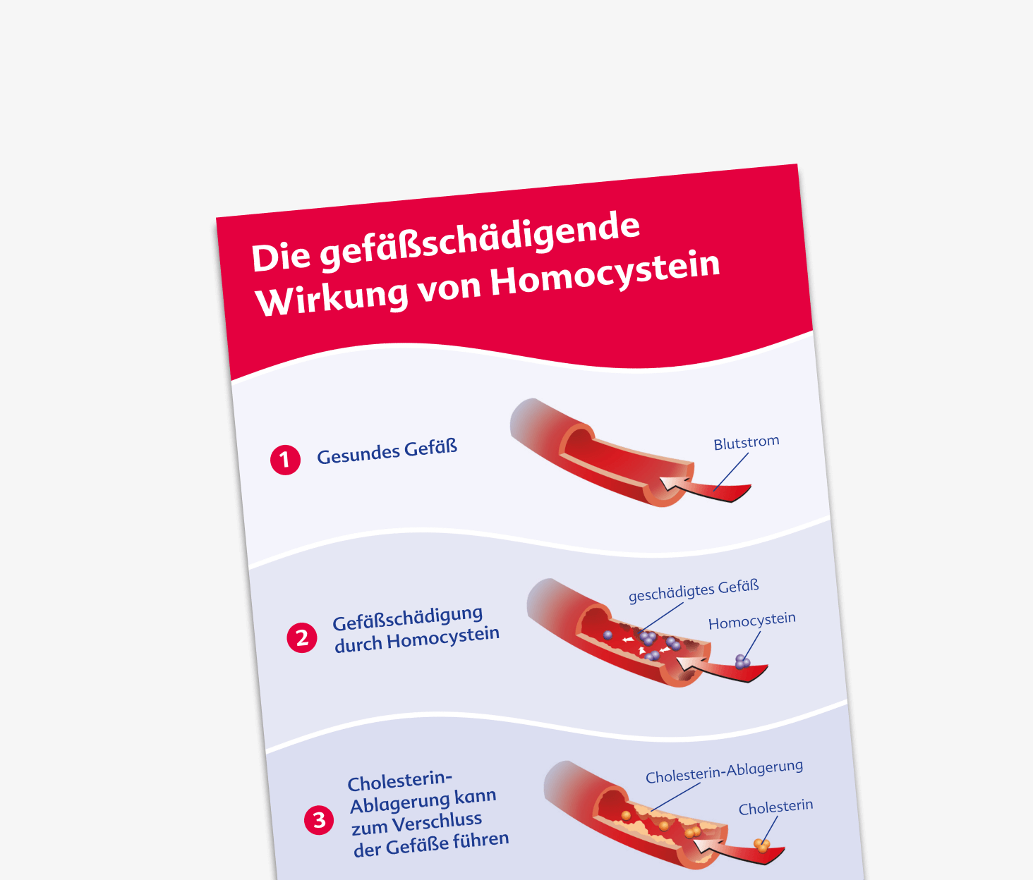 Gefäßschädigende Wirkung von Homocystein