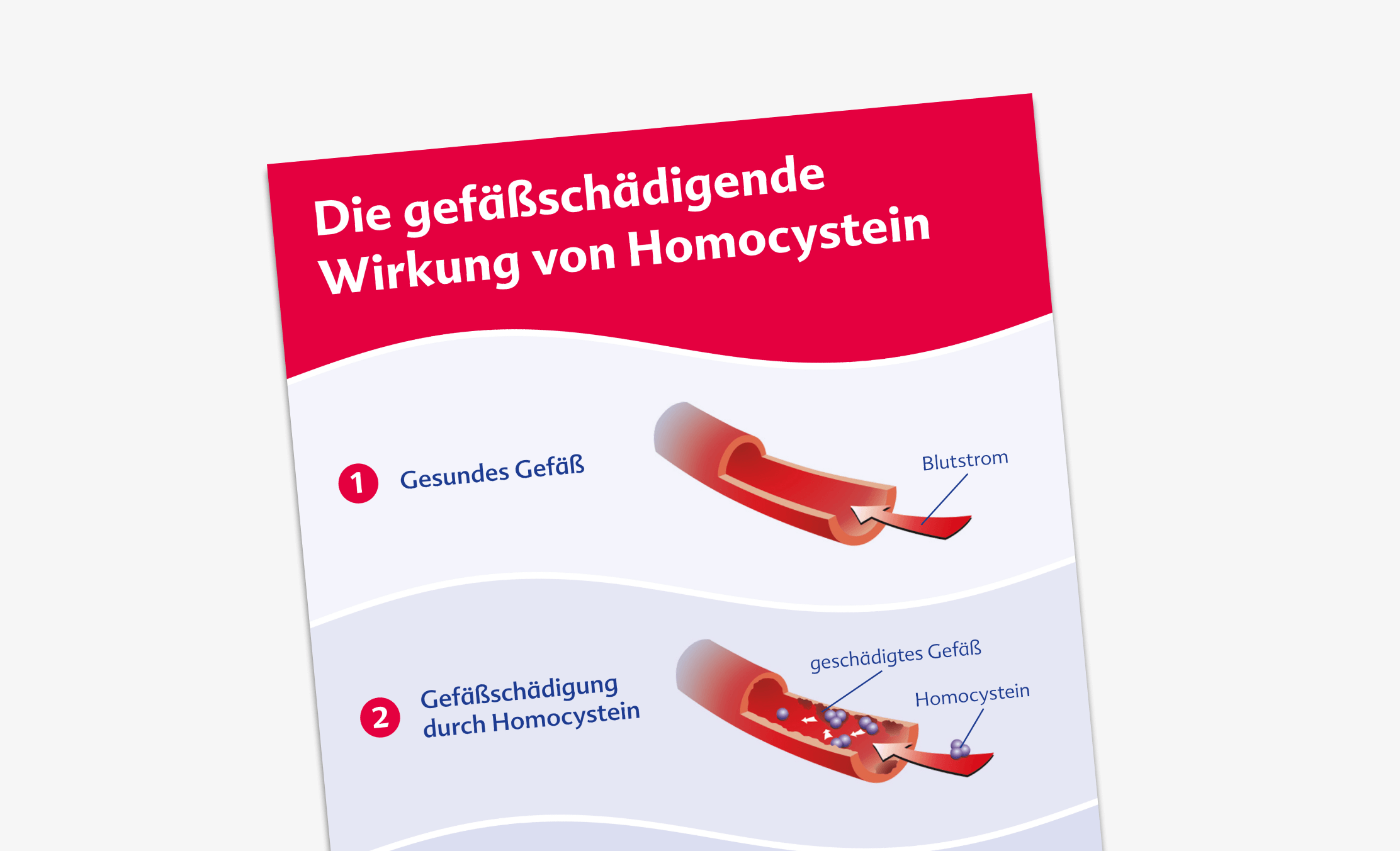 Gefäßschädigende Wirkung von Homocystein